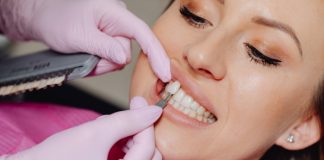 Do You Have to Get Your Teeth Shaved for Veneers?
