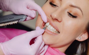 Do You Have to Get Your Teeth Shaved for Veneers?