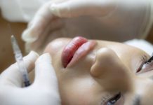 What to Consider Before Getting Fillers?