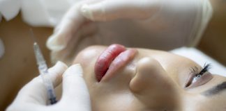What to Consider Before Getting Fillers?